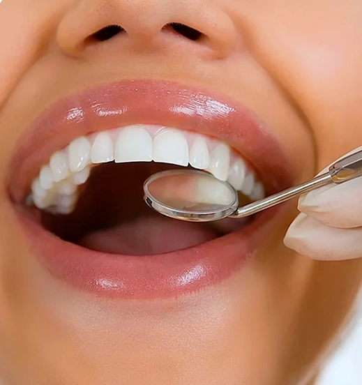 Dental professional examining a patient with a mirror during a preventive visit